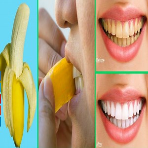1.6K views · 129 reactions | Banana peels don't do anything to whiten your teeth. Many articles recommend rubbing the peel against your teeth for a few minutes. While this could scrub off some surface stains, it's no more effective than brushing your teeth. Banana peels have no special whitening properties. | Health Zone | Facebook