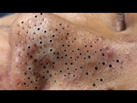 Enjoy Your Day With Hien Nguyen Spa # 1234