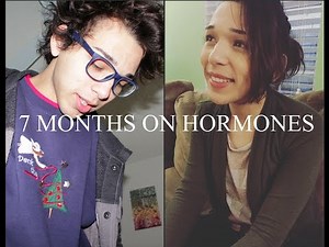7 MONTHS ON HRT | MTF Transition | Update