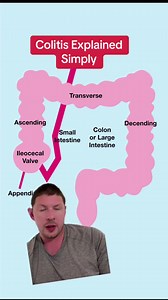 Colitis explained simply #colitis #ulcerativecolitis #colitiswarrior | Heal Your Gut Guy | Facebook