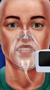 1.1M views · 4.7K reactions | Round head dots surgery treatment asmr...