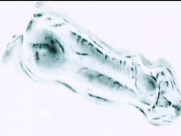 XRAY of Dogs Cock cumming inside of woman