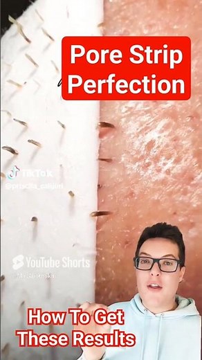 Worlds Greatest PORE STRIP REMOVAL - How To Use Pore Strips #shorts