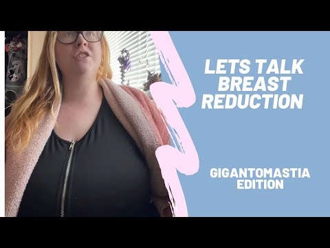 Let’s talk breast reduction, gigantomastia edition