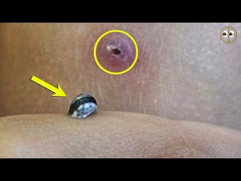 M0M squeezes W0UND on her S0N's KNEE and something BlZARRE JUMPS 0UT. It's UNBELlEVABLE what was ...