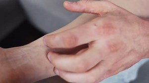 What do bed bugs eat and who do they feed on?