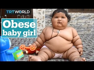 Obese baby leaves doctors confused