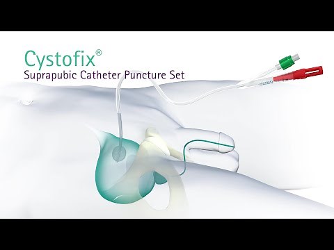 Cystofix Suprapubic Catheter Puncture Set