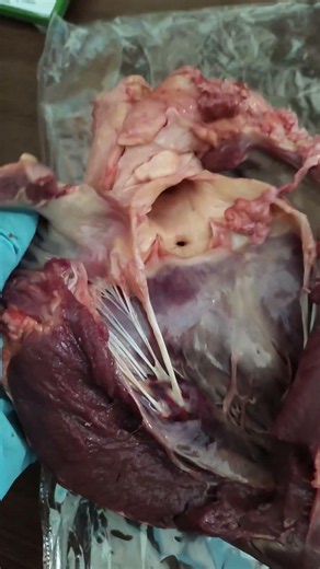What Is the Human Heart? | 4 Chambers & Heart Muscles Explained Simply ❤️ | Human Anatomy
