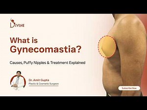 Male Breast Enlargement Explained | Gynecomastia Causes & Treatment | Dr Amit Gupta