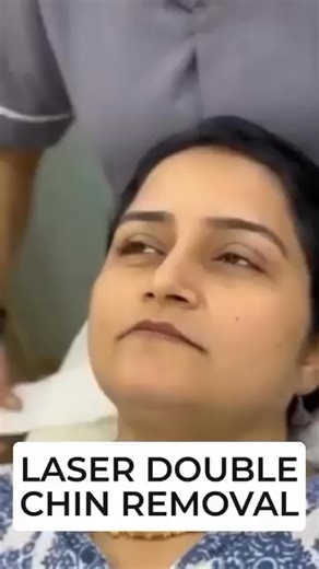 Explore laser-based chin contouring methods designed to enhance facial balance and definition. | WayRight Info