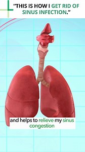 “This is how I get rid of sinus infection." 🫁 Lignosus™ helps improve respiratory health by reducing inflammation in the lungs and airways. 🔗Go get yours now! 👇👇 https://lignosus.com/lignosus-best-natural-respiratory-health-supplement/ 🍃Improves Breathing 🍃Supports Lung & Sinus Health 🍃Effectively Enhances Lung Health 🍃Naturally Relieve Cough & Phlegm 🍃Support Defence Against Cold & Respiratory Infection 🍃Sore Throat Remedy 🍃Strengthen Body Immune System #sinusremoval #sinusproblems #