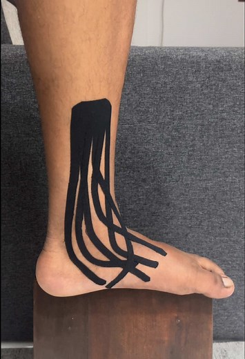 Ankle and Foot Swelling Relief with Kinesiology Tape