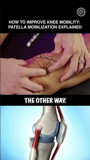 How to Improve Knee Mobility: Patella Mobilization Explained
