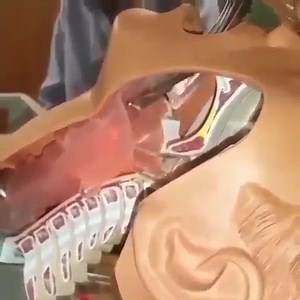 Tracheal intubation 🤭💯 | Physio capsules