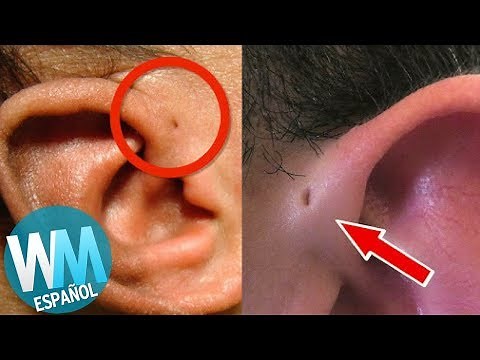 ¡Top 10 Cosas Raras Con Las Que Nacieron Algunos Niños!