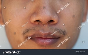 Nose Man Long Nose Hair Comes Stock Photo 1330976540 | Shutterstock