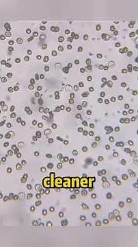 The Truth About HIV Blood Under a Microscope #HIVawareness #foryou