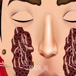 Best squid game pink soldier treatment animation asmr | Asmr Treatment