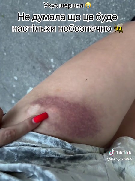 Close-Up Feet and Leg Movements on Paved Surface