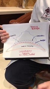 Inner Labiaplasty Techniques: Trimming and the Wedge Excision