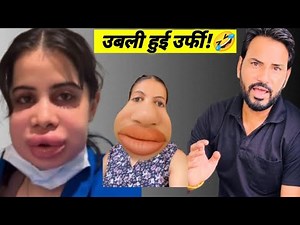 Why Lip Fillers Are The Worst 🤣 | Full Roast #funny #comedy