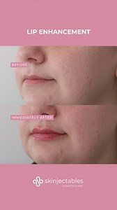 Step into Nurse Glenda’s office! This patient came in wanting a...