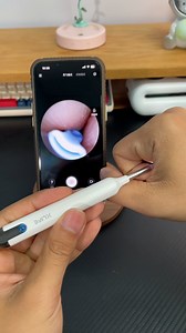 472K views · 41 reactions | Technology changes life and gives you a different experience #iphone ear picking ear scoop visual ear scoop #ear picking is so comfortable #reels | Trendy Tech Review | Facebook