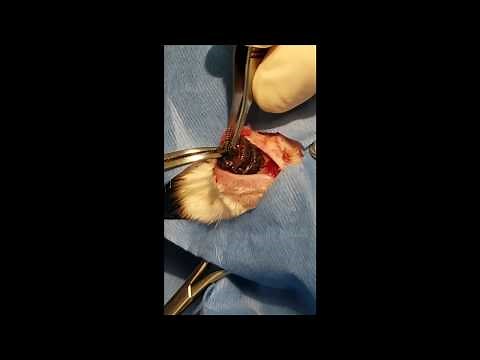 HUGE! Cuterebra Removal