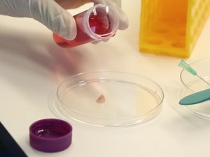 Working with Human Tissues for Translational Cancer Research