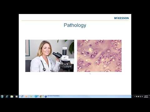 Mastering ICD-10-CM for Radiology, Pathology, and Lab Webinar