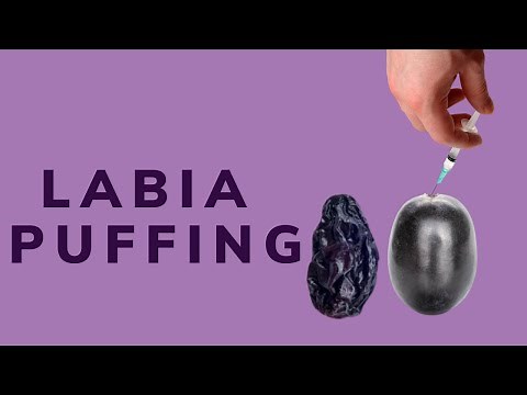 Labia Puffing in Los Angeles | Dr. Michael Tahery