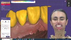 9.4K views · 113 reactions | 3D Face Scanning was used for the first...
