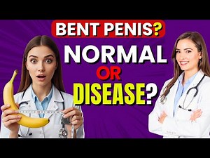 Got a bent penis? Here’s when you should really worry!