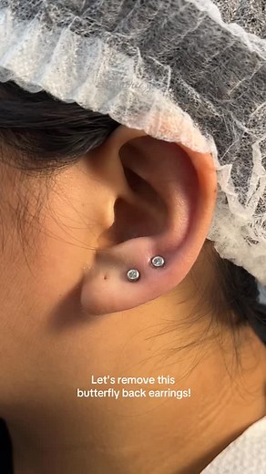 NO TO PIERCING GUNS!❌ Removal of butterfly back earrings for #lobepiercing #piercingstudio #piercingaddict #piercingmalolos #piercingshop #gonewrong #nocopyrightinfringementintendedmusicbelongstotherightfulowner | Pierce Yow