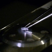 Video: Olfactory Neurons Obtained through Nasal Biopsy Combined with Laser-Capture Microdissection: A Potential Approach to Study Treatment Response in Mental Disorders