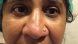 2.5K views · 14 reactions | Brown to Permanent Turquoise Green Eyes. | BrightOcular | Facebook