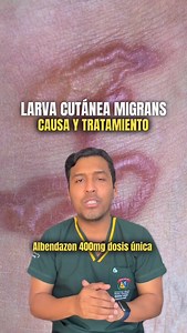 Larva cutánea migrans. 🐛🪱 | Soy Rawdy