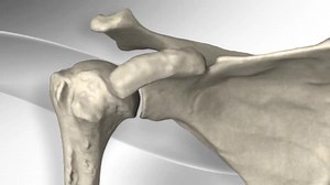 Le système de prothèse totale de l'épaule Univers™ II