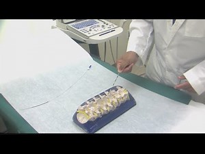 Electric Pain Device “Stimwave”