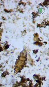 🦠Rotifer; a microscopic, multi-celled animal, barely half a millimeter long. Despite their size, they have a brain, a stomach, and a nervous system. They are known for surviving extreme conditions, even returning to life after being frozen for 24,000 years in Siberia. Because they tolerate low-oxygen and even toxic environments, seeing many of them in soil or compost can signal that conditions may be shifting toward anaerobic (low oxygen), not what we aim to create in soils. Remarkable survivor