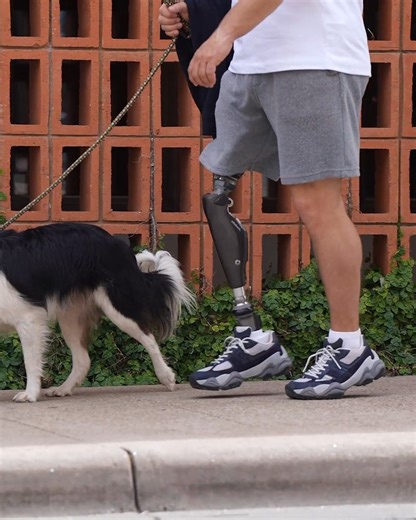 可以交替下樓梯的智能義肢 C-Leg 4，來體驗一下？樂 With the C-Leg microprocessor knee, Chance chooses proven performance! 了解更多 Learn More: https://bit.ly/contact-us-hk #ChooseProvenPerformance #CLeg #MicroprocessorKnee #Ottobock #WeEmpowerPeople #奥托博克 #義肢 #prosthetic #prosthetics #義肢装具 | Ottobock | Facebook