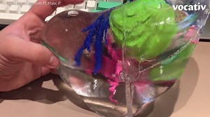 23K views · 198 reactions | This 3D printed liver could help doctors better prepare for surgery. (via our friends at Vocativ Video) | Inverse | Facebook