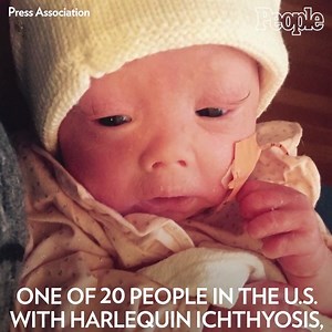 50K views · 666 reactions | Harper Foy is celebrating what makes her different. ❤️ | People | Facebook