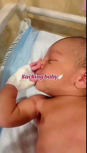 NICU Baby Sucking Reflex Explained #nicubaby #neonatologist #newbornbaby #cute