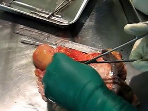 Female Genital - Medical Examination