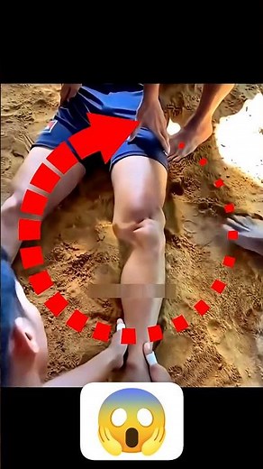 😱Dislocated Joint? Quick Fix Explained! #shorts #unfilteredclasses