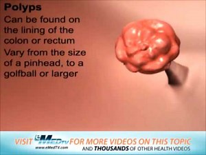 Common Colon Problems