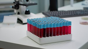 Close up of vacutainers with liquid blood in laboratory on desk. Tray of research test bottles for fluid dna preparing science analysis. Equipment for pharmaceutical development industry