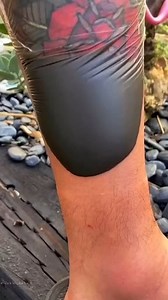 Skin problem solution  #skinproblems #skincare #skincareroutine #skin #healthtips #ai #explorepage #trending #explore | Healthcare Tips | Facebook